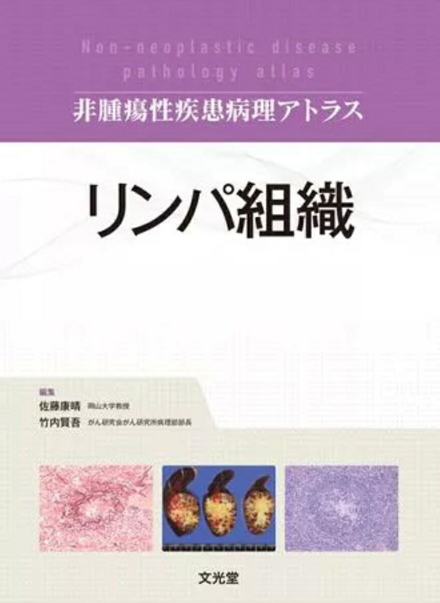 楽天ブックス: 肝胆膵 (非腫瘍性疾患病理アトラス) - 原田 憲一