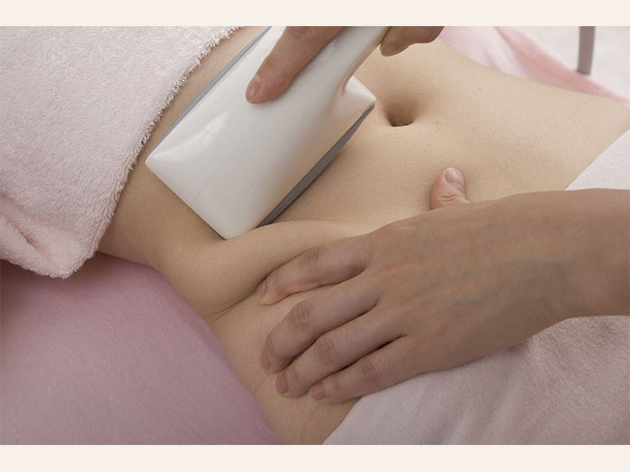 切らない脂肪吸引“スターバック”で頑固なセルライトを撃退