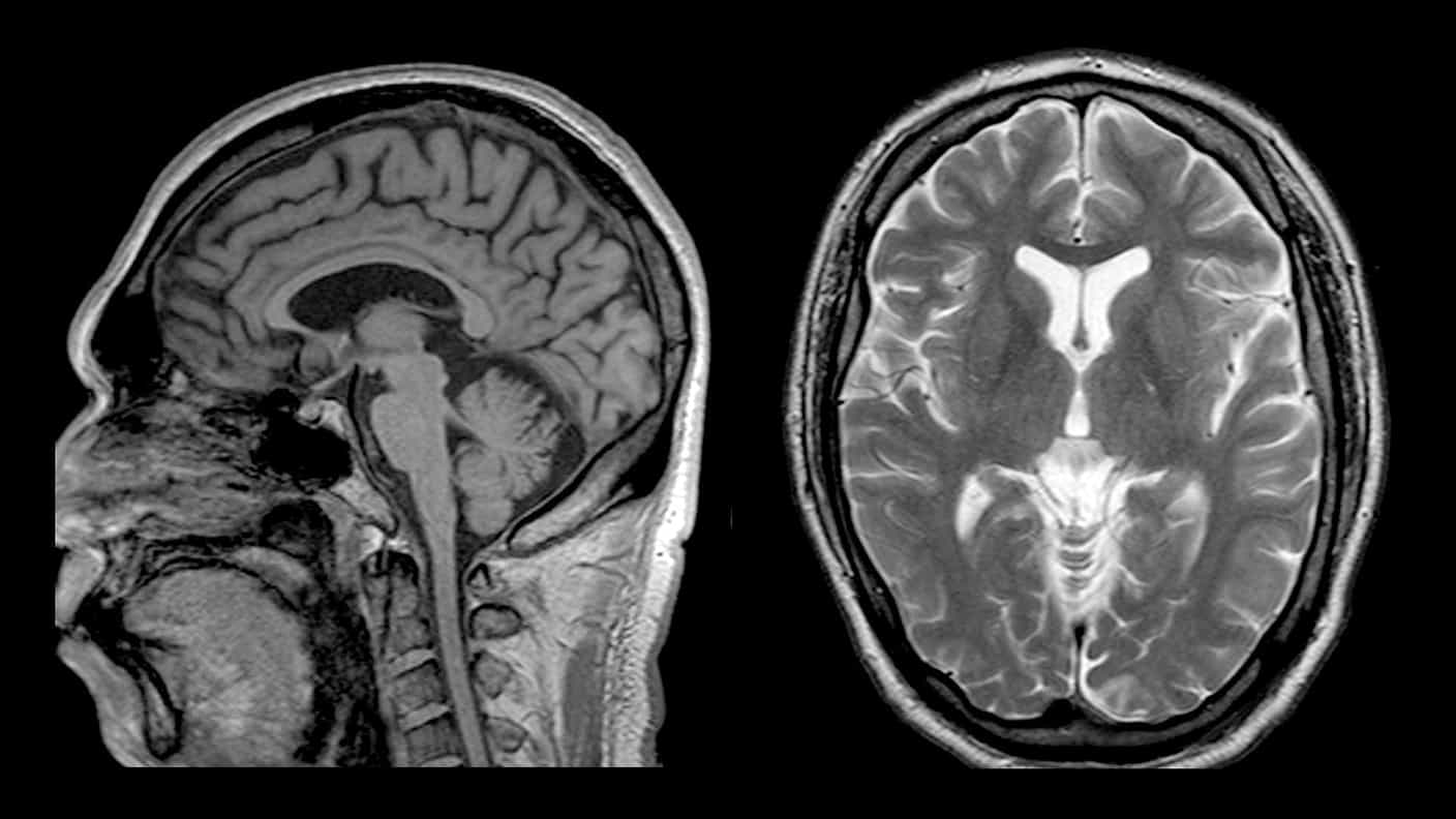 MRI・CT・エコー案内｜チョコザップ｜24時間使えるコンビニジム | 運動