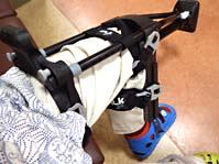 カナダ脚；iWalkfree 2.0（ニークラッチ：アイウォークフリー）