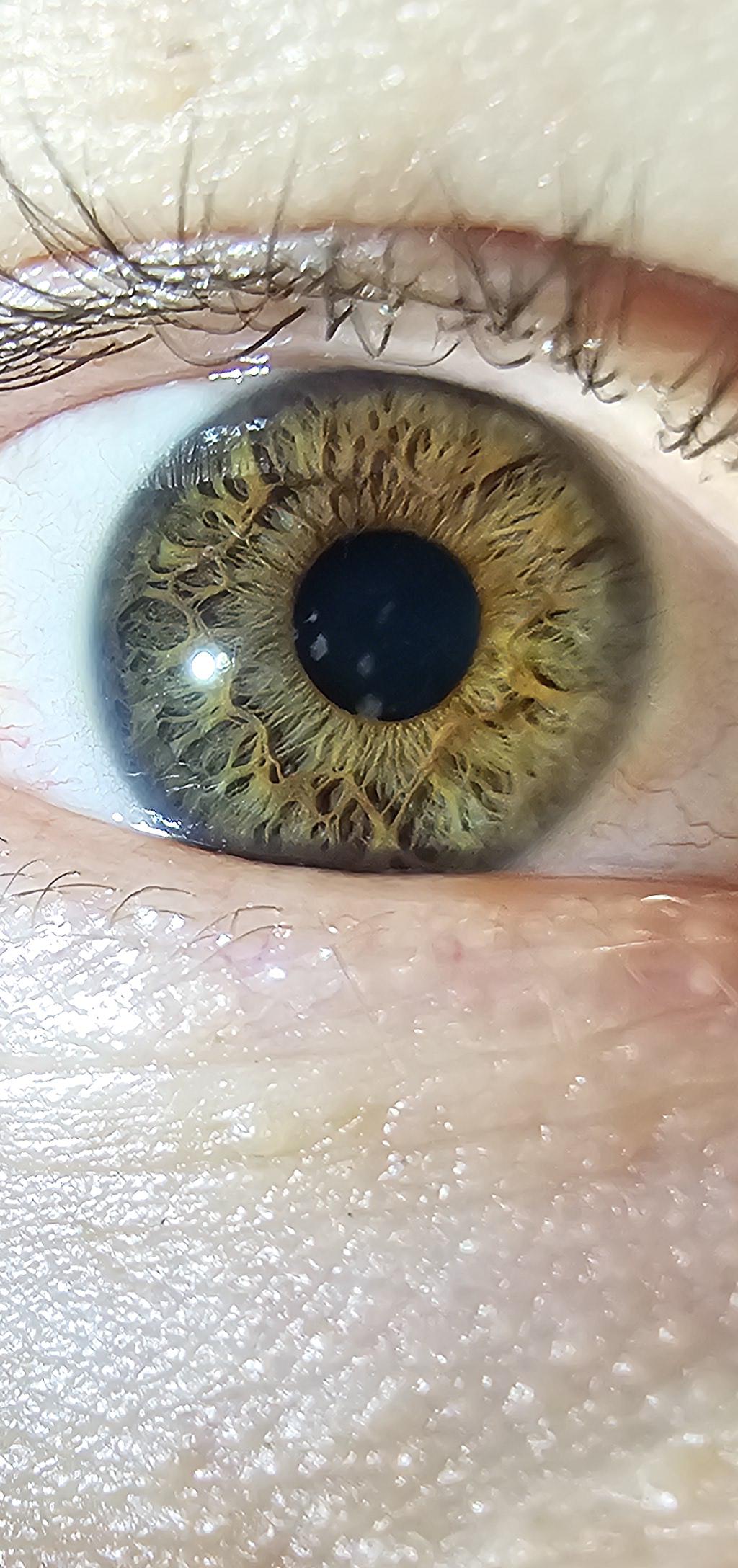 私の虹彩、ひまわりみたい🌻 : r/eyes