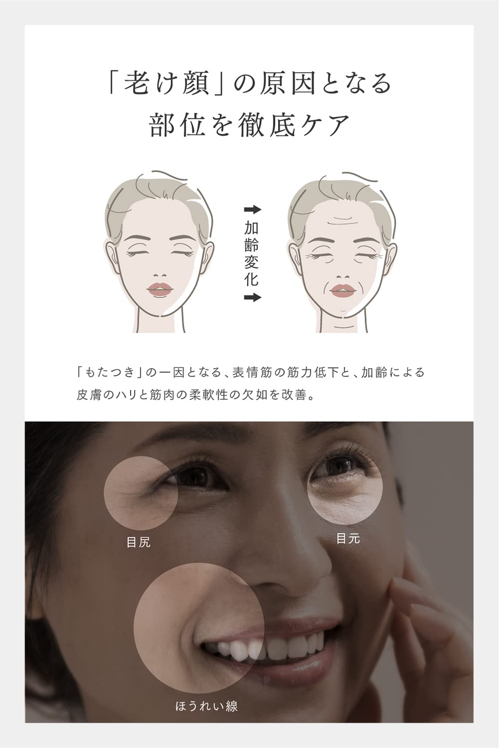 Amazon | 【マイベストで総合1位受賞！】MYTREX PROVE対応